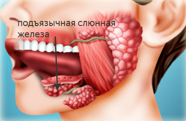 Решение рисунок 1